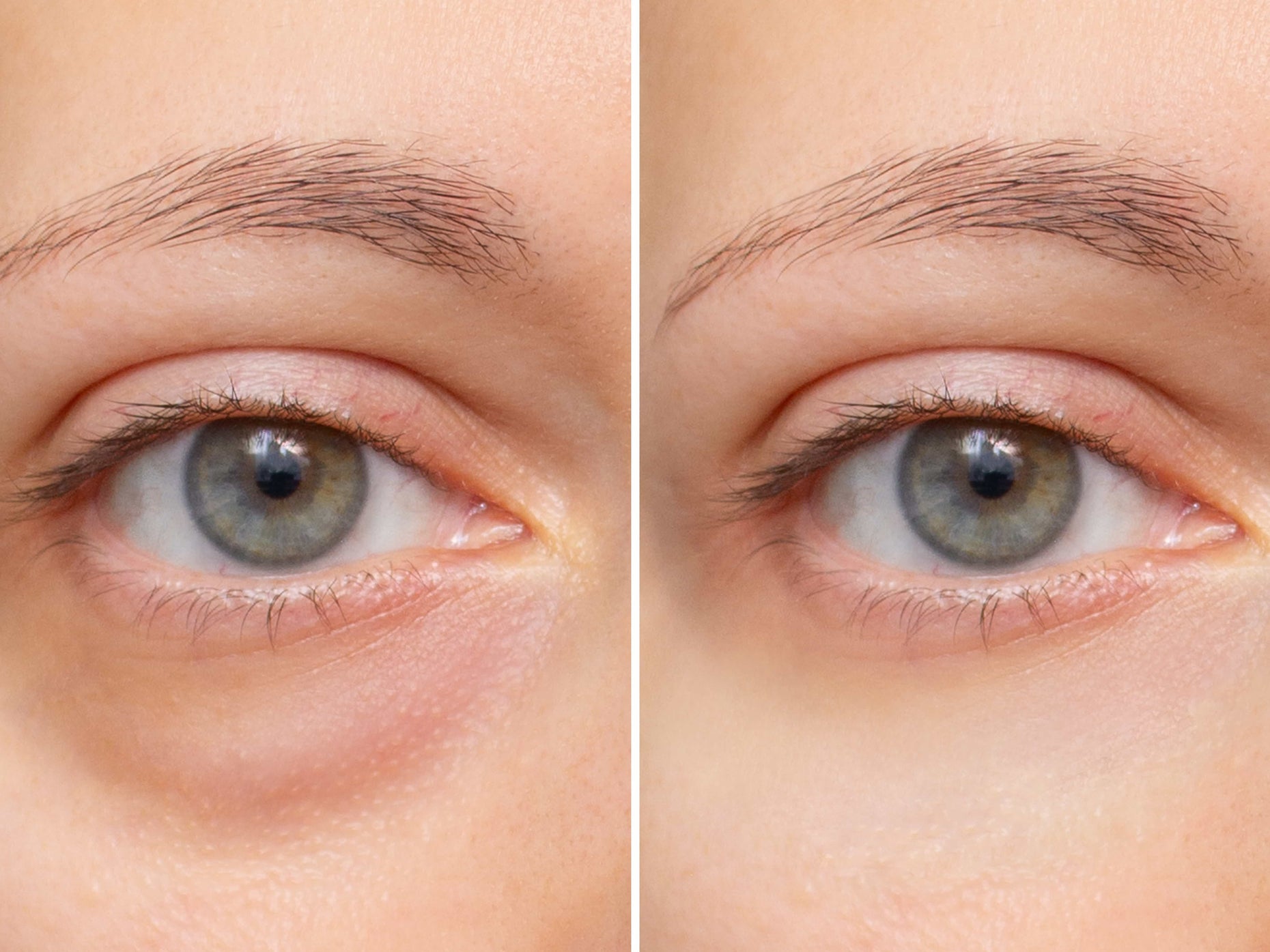 How Quickly Does Arnica Work? Timeframe For All Uses – Legend's Creek Farm