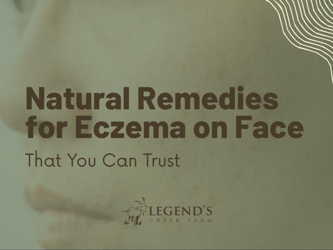 Natural Remedies for Eczema on Face You Can Trust